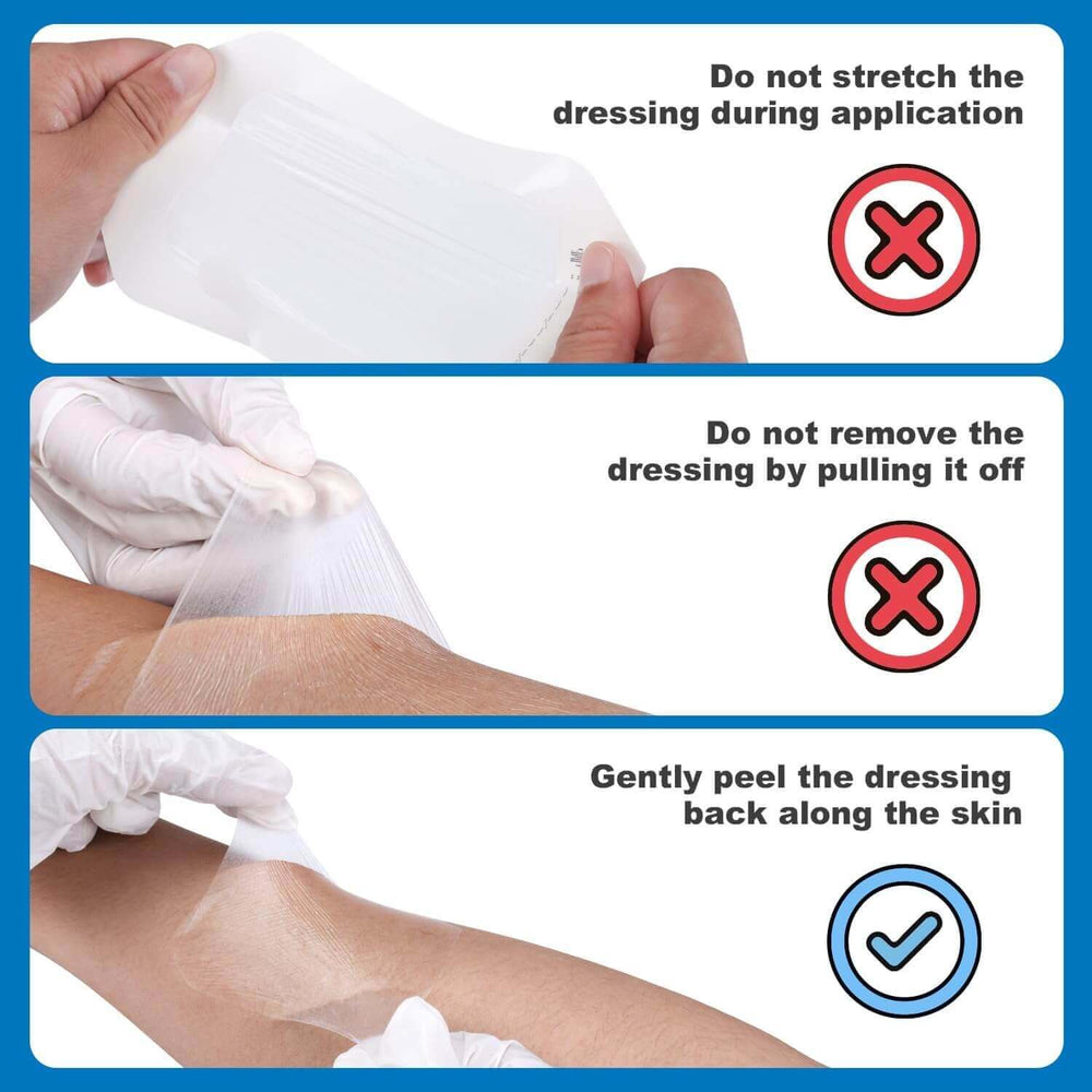 FRESINIDER transparent film dressing application and removal instructions for gentle use