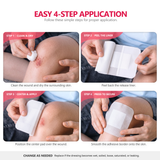 Four steps for applying a FRESINIDER island dressing