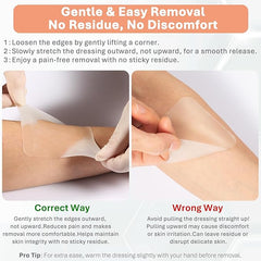 how to remove hydrocolloid wound dressing correctly