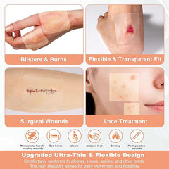 hydrocolloid wound dressing for blisters burns surgical wounds acne