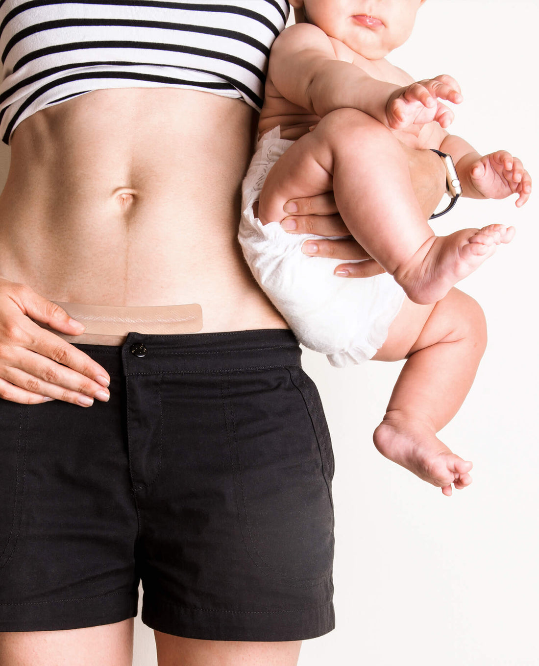 A C-Section Mom's Story