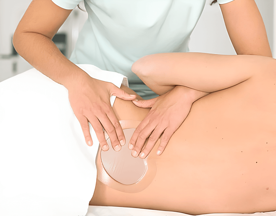 Pressure Ulcer Dressings