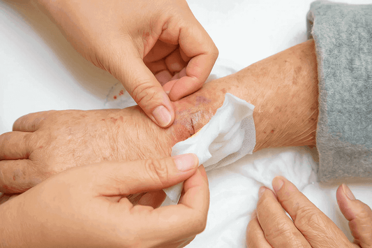 Remove Gauze Stuck to Wound