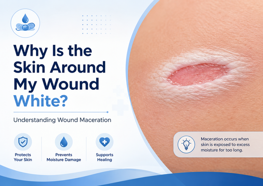 White softened skin around a wound showing signs of wound maceration