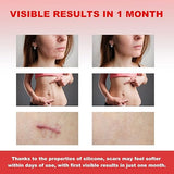 FRESINIDER Silicone Scar Roll Sheet