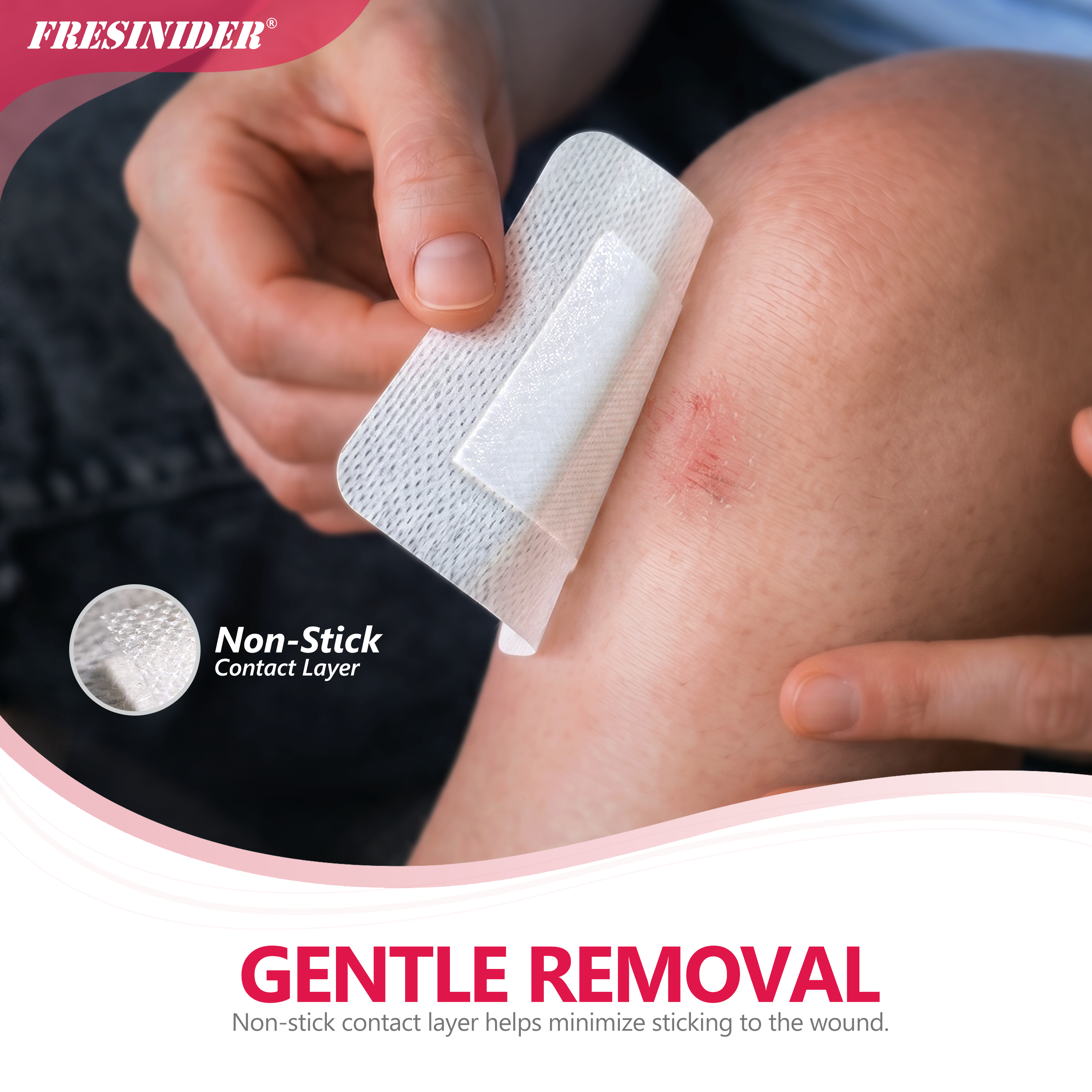 FRESINIDER island dressing with a non-stick contact layer being gently removed from a minor knee abrasion