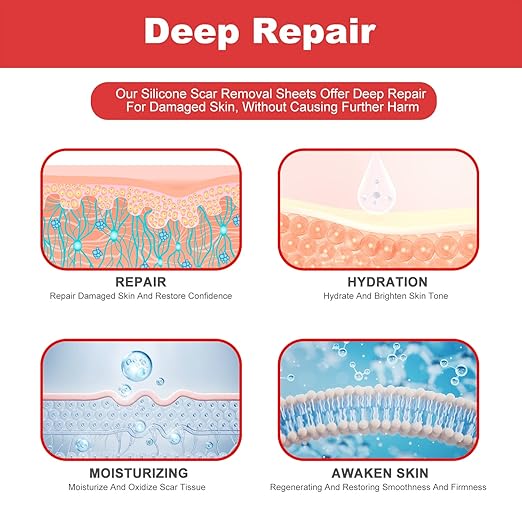 FRESINIDER silicone scar roll sheet for deep repair hydration and scar care