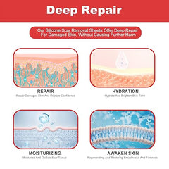 FRESINIDER silicone scar roll sheet for deep repair hydration and scar care