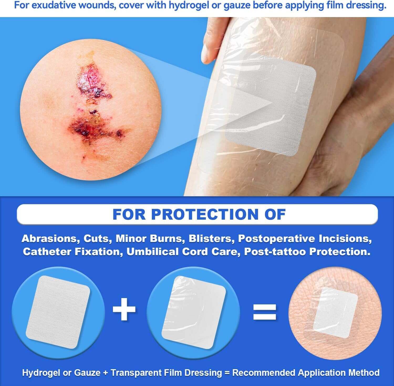 FRESINIDER transparent film dressing for covering gauze or hydrogel on exudative wounds