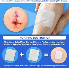 FRESINIDER transparent film dressing for covering gauze or hydrogel on exudative wounds
