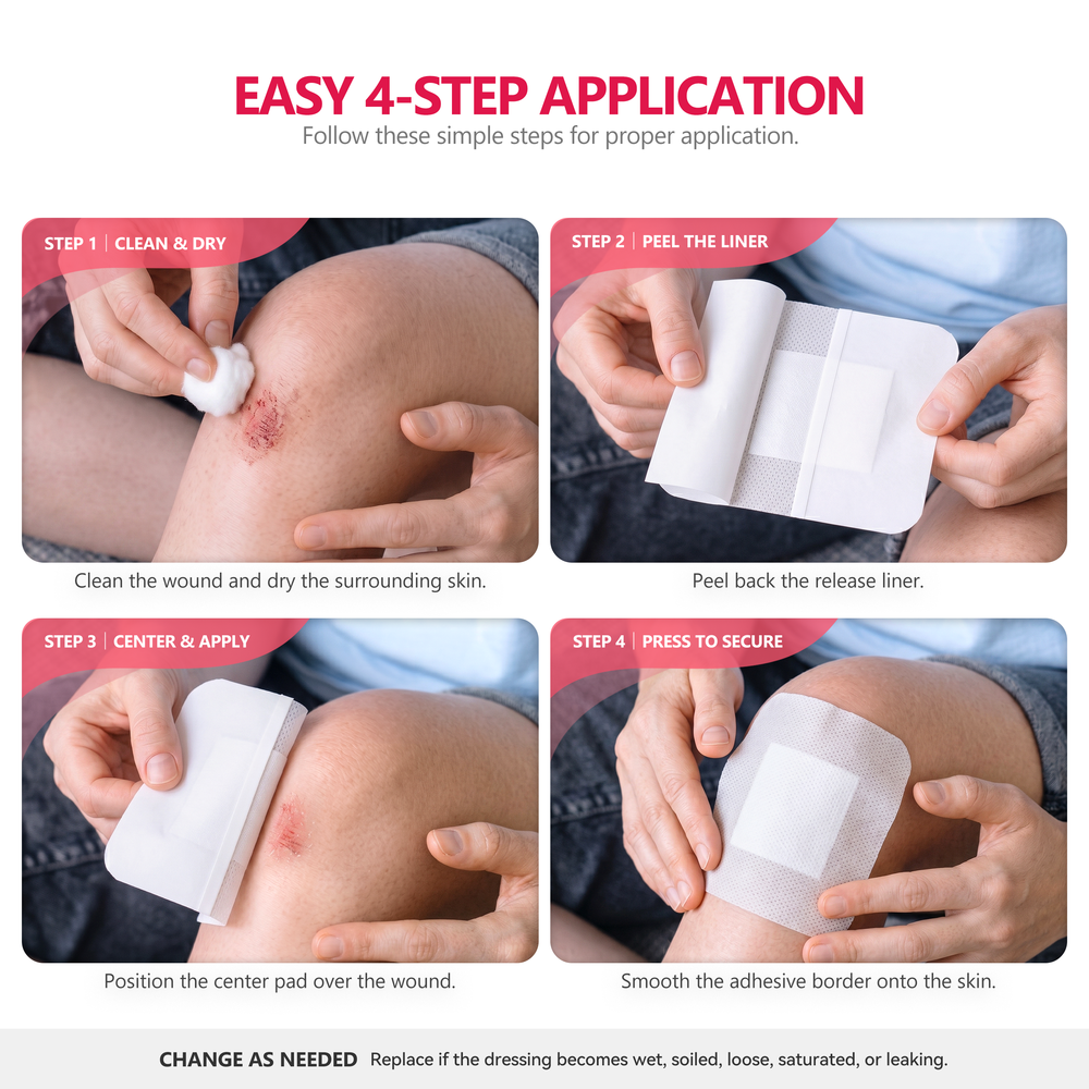 Four steps for applying a FRESINIDER island dressing