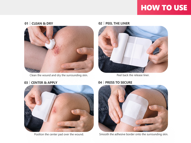 Four steps to apply a FRESINIDER island dressing