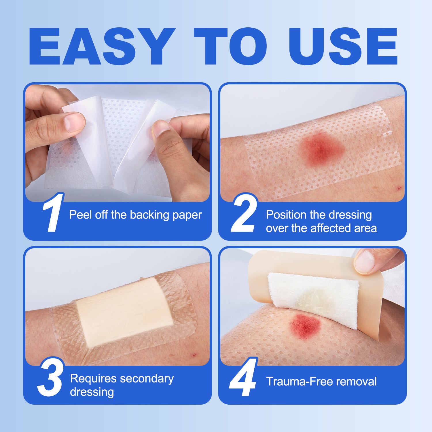 FRESINIDER Silicone Wound Contact Layer