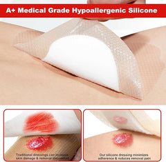 Medical Grade Hypoallergenic Silicone Dressing
