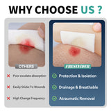 Silicone contact layer comparison