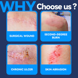 FRESINIDER Silicone Wound Contact Layer