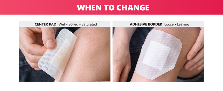When to change a FRESINIDER island dressing